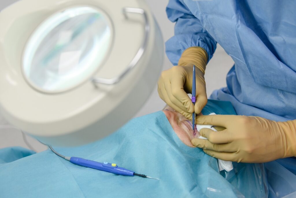 operace vicek dr kopecky